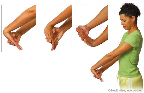 Carpel Tunnel Syndrome Wrist Exercises